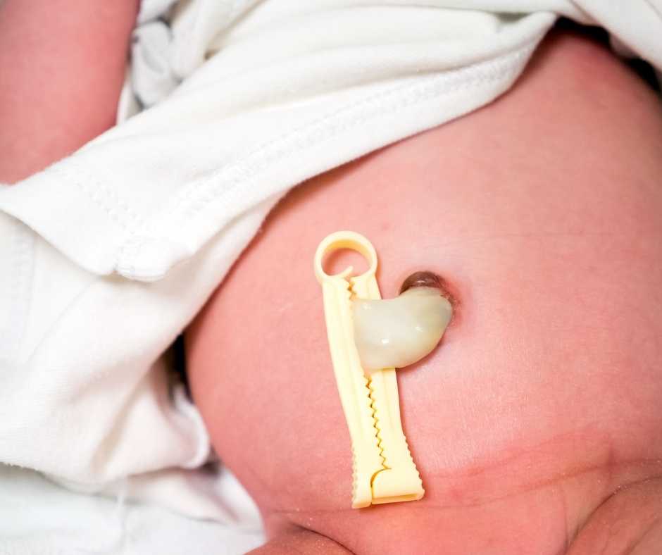 umbilical cord -baby hack